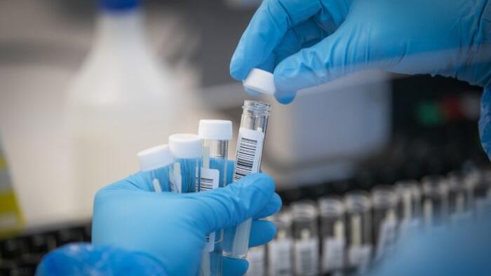 Britain Temporarily Suspends PCR Test For Asymptomatic COVID Cases - Vimarsana News