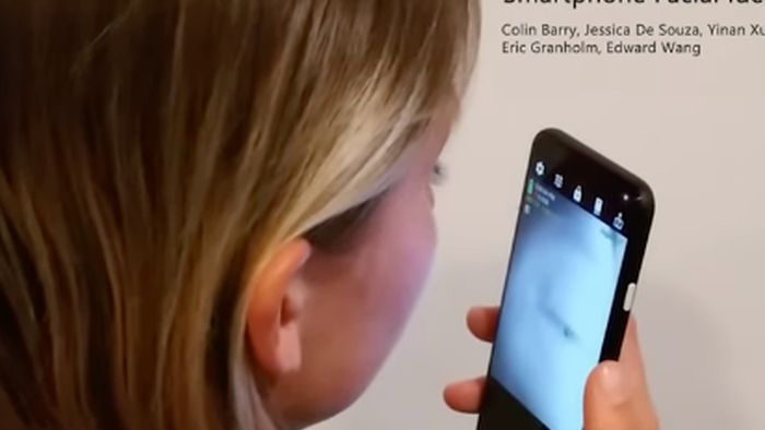 Watch: Selfie App Scans Eyes For Neurological Diseases - Vimarsana News
