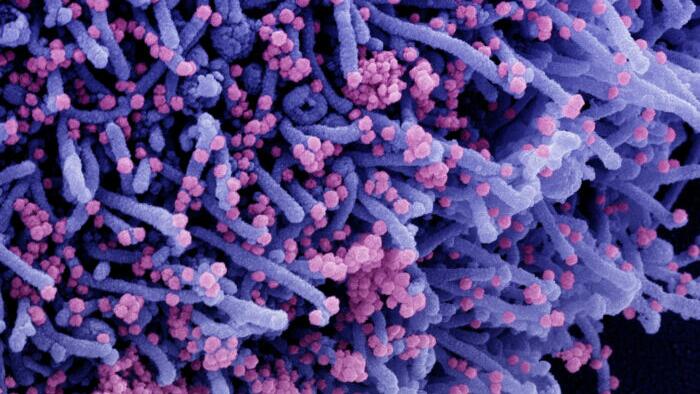 Natural Immunity 97% Effective Against Severe COVID-19 After 14 Months: Study