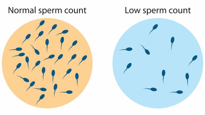 NextImg:Global Sperm Counts Declining At Accelerating Rate: New Meta-Analysis