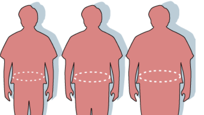 NextImg:There's No Such Thing As 'Healthy Obesity'
