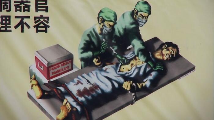 NextImg:House Overwhelmingly Passes 1st Ever US Bill To Punish CCP’s Forced Organ Harvesting
