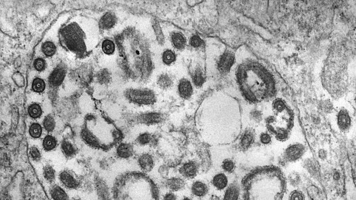 NextImg:CDC Warns About Deadly Marburg Virus Amid Outbreaks In Africa