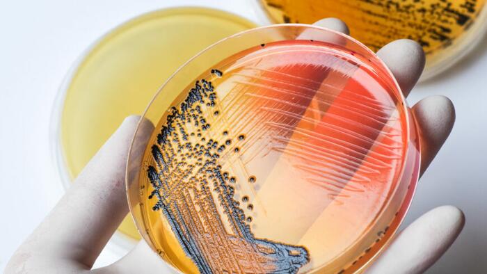 NextImg:Salmonella: From Drug Resistant To Extensively Drug-Resistant (XDR)