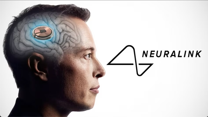 NextImg:Musk's Brain Implant Startup Receives FDA Approval For Human Tests