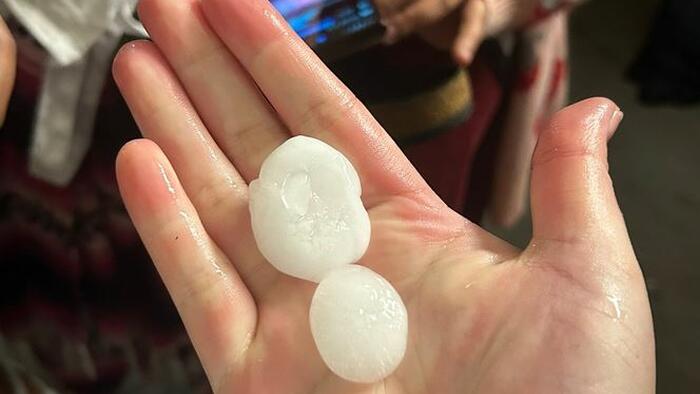 NextImg:Nearly 100 People Injured by ‘Golf Ball-Sized’ Hail at Louis Tomlinson Concert