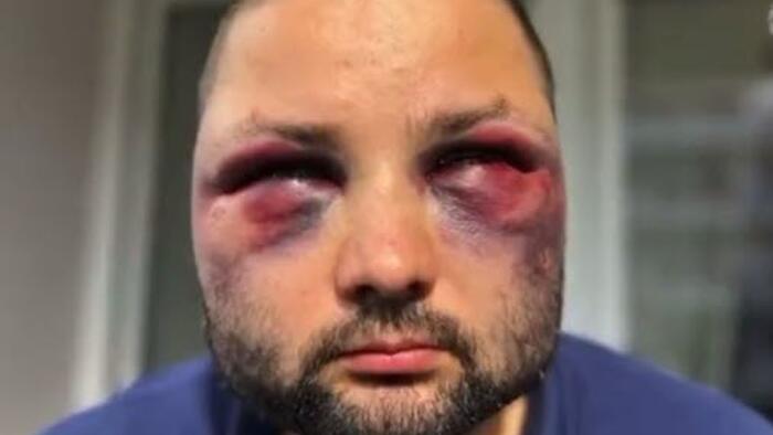NextImg:AfD Bavaria Chief Beaten Up In Organised Migrant Attack