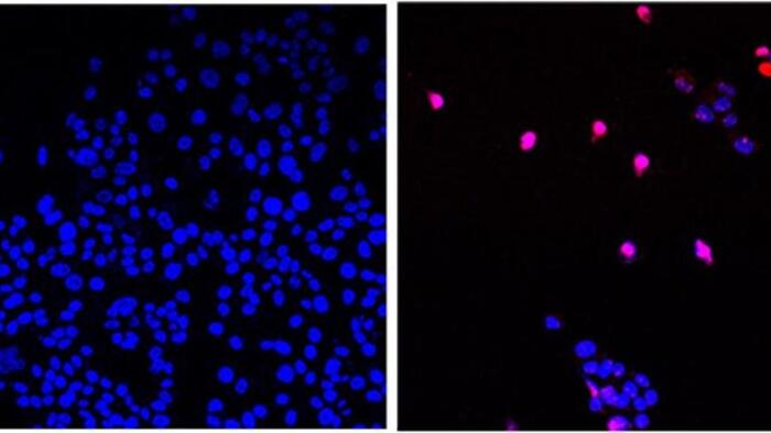 NextImg:US Scientists Develop New 'Cancer-Stopping Pill' That Can 'Annihilate' Tumors