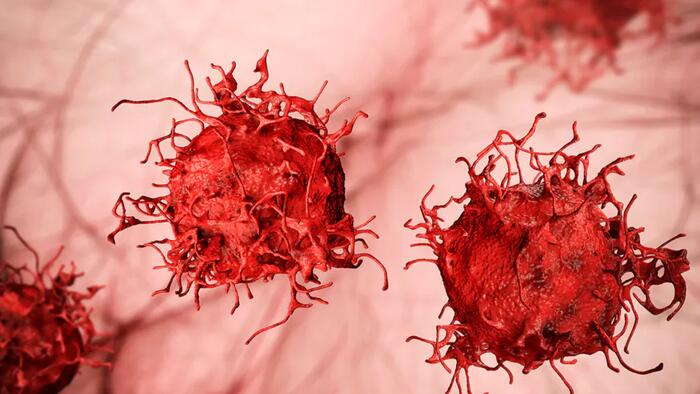 NextImg:Researchers Discover Concerning Cancer Trend In Young Adults