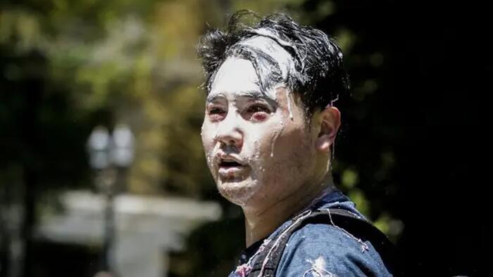 NextImg:Andy Ngo Awarded $300,000 In Antifa Attack Lawsuit