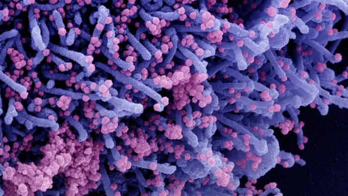 NextImg:COVID Reinfections Clear Faster, Including In Unvaccinated People: Study