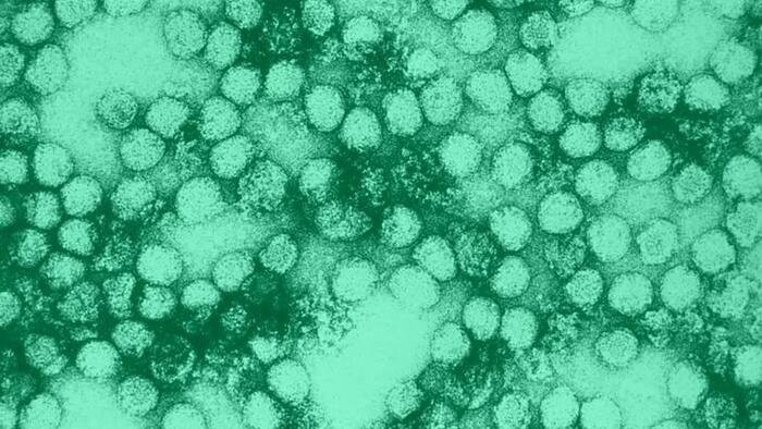 NextImg:"There Is No Cure": Long-Forgotten Virus Could Return, US Is Not Prepared
