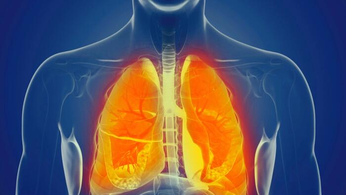 NextImg:Poor Oral Health Speeds Up Irreversible Lung Disease: Study