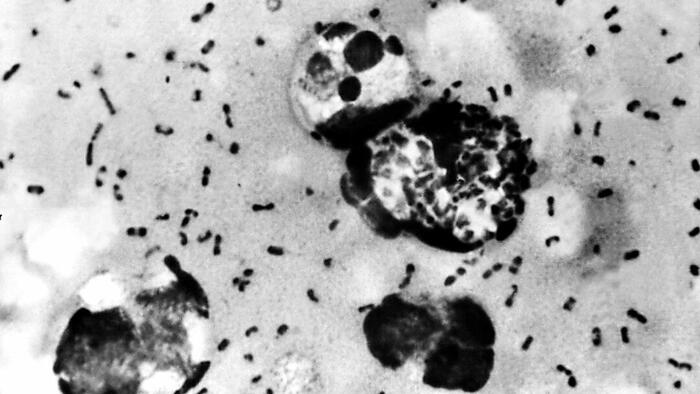 NextImg:Health Officials: Man Dies From Bubonic Plague In New Mexico
