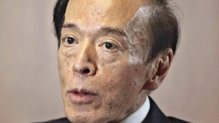 NextImg:Intervention Or Not, Yen Bears Will Stay Confident