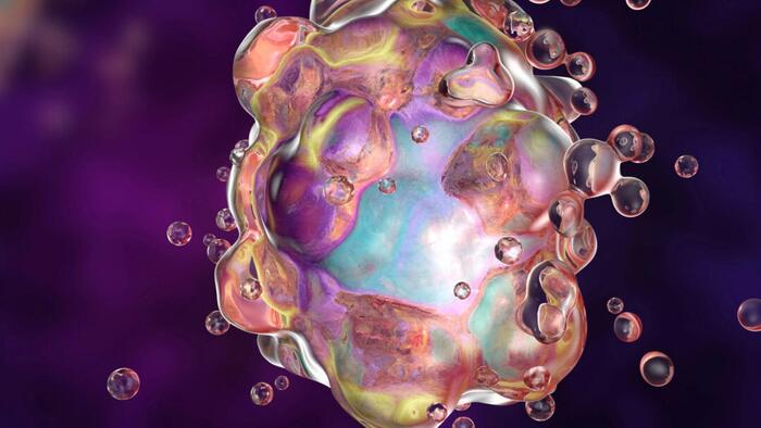 NextImg:Research Suggests Unusual Form Of Cell Death Causes Severe COVID-19 Lung Damage