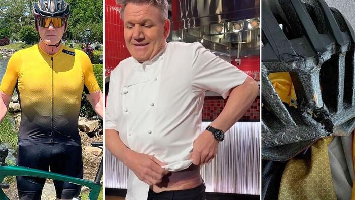 NextImg:Watch: Badly Wounded Gordon Ramsay Shows Off Massive Bruise, Says Bike Helmet Saved His Life