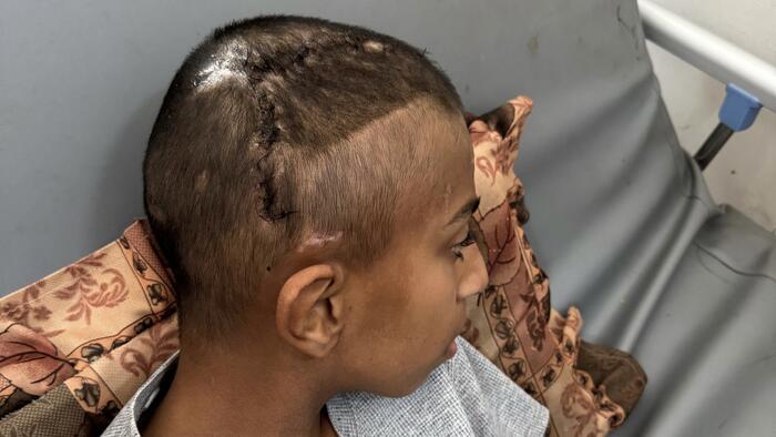 NextImg:US Doctors Stunned By Number Of Gaza Children With Headshot Wounds