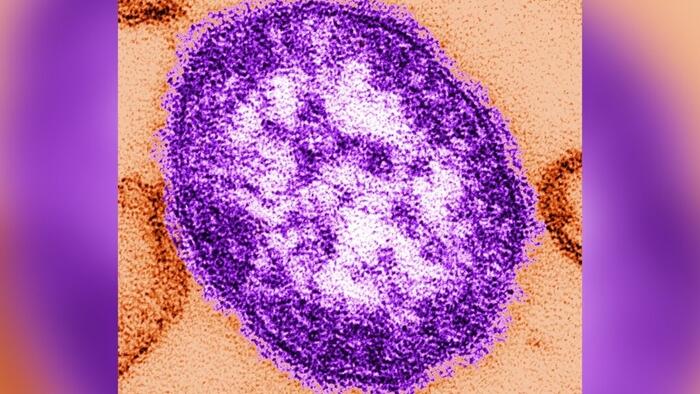 NextImg:CDC: Measles Cases In US So Far This Year Already Triple 2023 Total