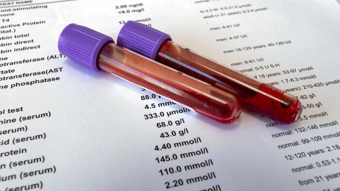 NextImg:Understanding Lab Tests For Optimal Health