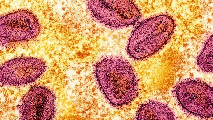NextImg:WHO Launches Global Monkeypox Strategy, Including Strategic Vaccinations