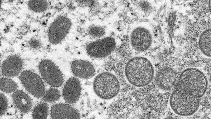 NextImg:Drug Company Announces It Will Produce Millions Of Monkeypox Vaccines By Next Year