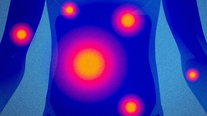 NextImg:Inflammation: The Body's 'Fire' Burns Threats, But Things Go Wrong When It Smolders