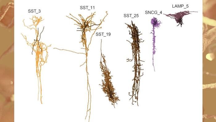 NextImg:'Silent Phase' Of Alzheimer's Begins Decades Before Symptoms, NIH Study Suggests