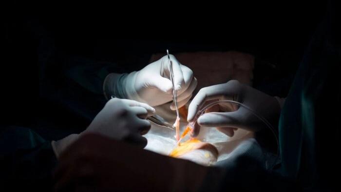 NextImg:Taiwan Indicts Surgeon Who Sent Patients To China for Organ Transplants