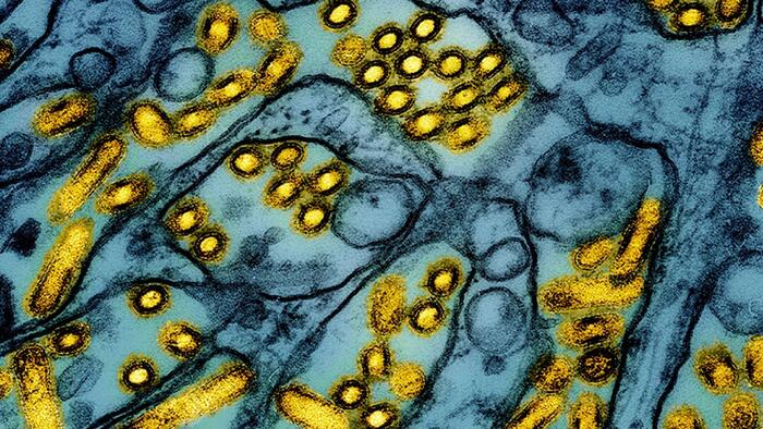 NextImg:WHO Says Bird Flu Risk Low After 1st H5N1 Death In US