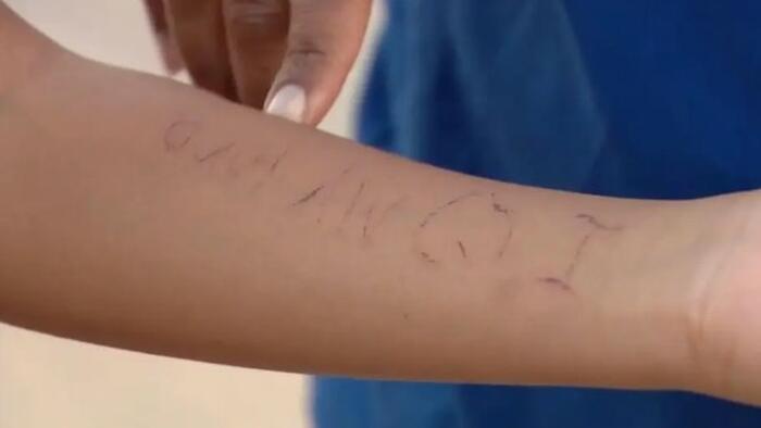 NextImg:Texas Middle-Schoolers Secretly Tattooed Each Other Using Shared Needle In Classrooms