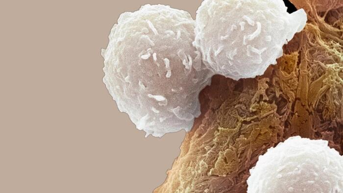 NextImg:Cancer Cells 'Cooperate' To Survive, Study Finds