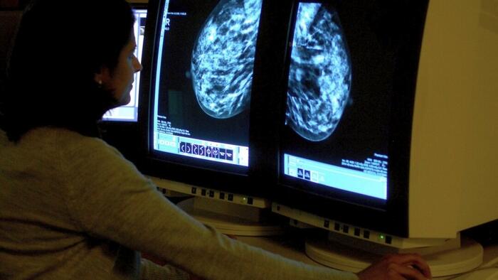 NextImg:Experts Warn That UK Cancer Care System Is At "Critical Breaking Point"