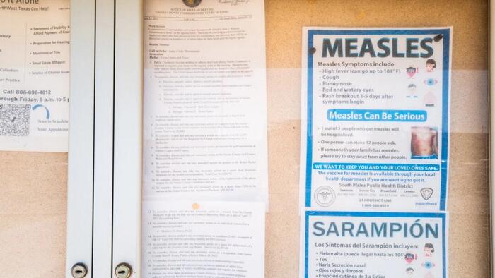 NextImg:Measles Outbreak Likely Bigger Than Thought: CDC