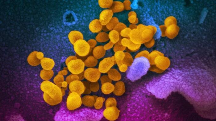 NextImg:COVID 'Razor Throat' Variant Now Found In 15 US States: Here's What We Know