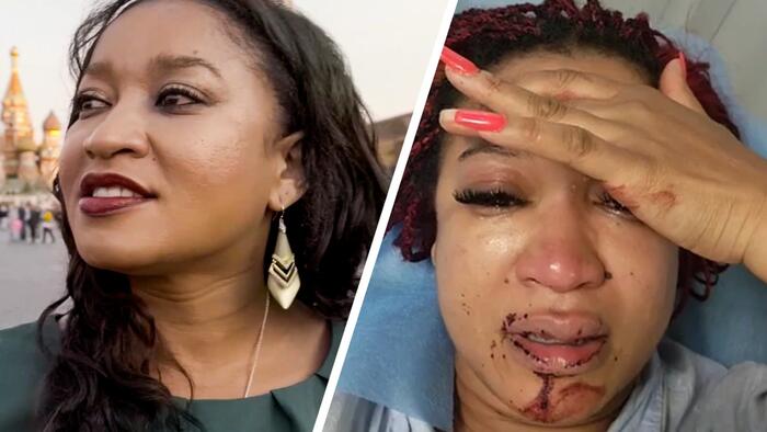 NextImg:Black Woman Who Left US For Russia To "Escape Racism" Beaten By New Neighbors