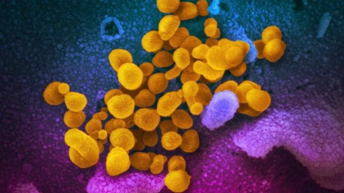 NextImg:CDC Releases Update On 'Long COVID' Symptoms