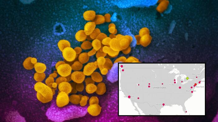 NextImg:21 States Across US Now Reporting COVID 'Razor Throat' Variant