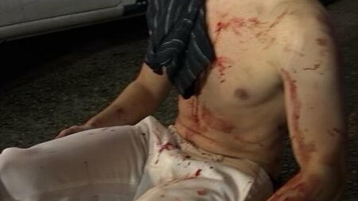 NextImg:DOGE Worker "Big Balls" Bloodied After DC Attack; Trump, Musk Call To Federalize DC 