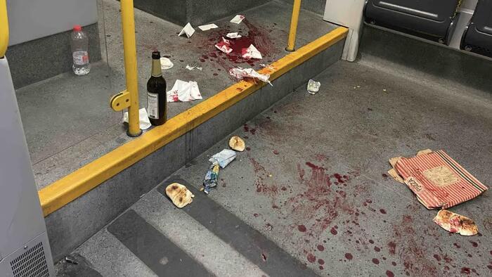 NextImg:American Knifed In Face By Syrian After Intervening To Protect Women On German Train