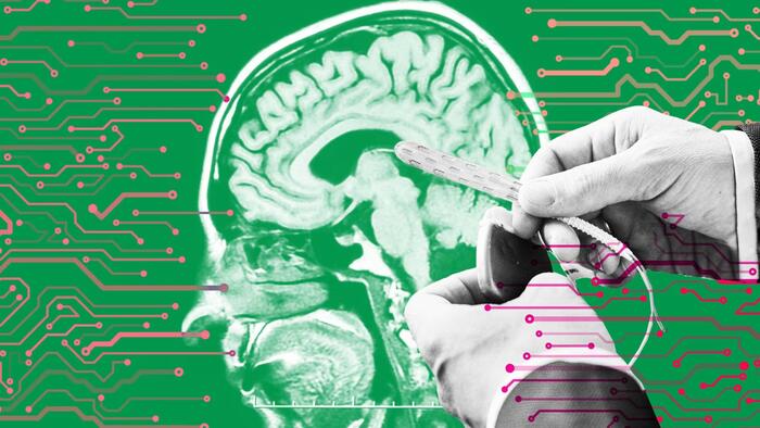 NextImg:Big Tech Could Soon Use Brain Chips To Read Your Innermost Thoughts: Study