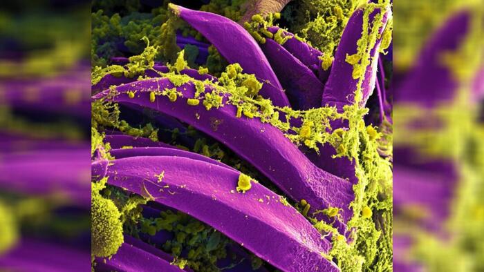 NextImg:New Mexico Man Diagnosed With Plague In State's First Case This Year, Say Officials
