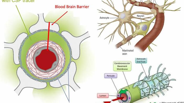 Reversing Alzheimer’s: The Forgotten Causes And Cures Big Pharma Buried