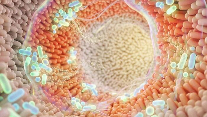 Your Gut Microbiome Could Affect Colon Cancer - What You Can Do