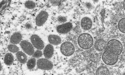 USA dążą do rozszerzenia testów na małpią ospę 1 1.tagreuters.com2022binary LYNXMPEI4S0EW FILEDIMAGE