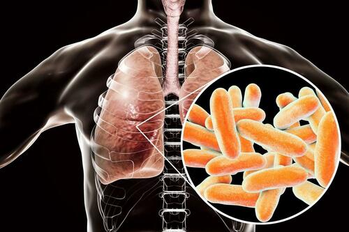 Officials Tracking Growing Outbreak Of Legionnaires' Disease In New York