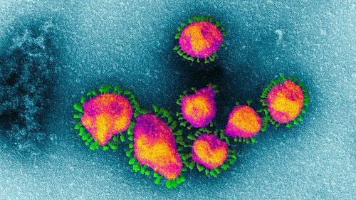 COVID-19 HIV Spike Protein Gene: Virologists Confirm No Credible Natural Ancestor