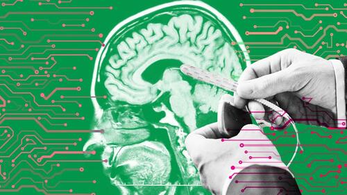 Big Tech Could Soon Use Brain Chips To Read Your Inner Most Thoughts: Study