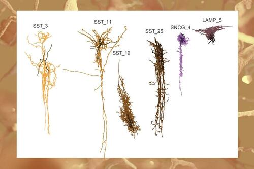 ‘Silent Phase’ Of Alzheimer’s Begins Decades Before Symptoms, NIH Study Suggests