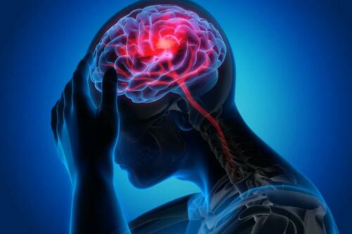 Stroke Could Be Transmissible, Study Finds